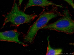 HAX1 Mouse Monoclonal Antibody, Proteintech:Antibodies:Primary Antibodies