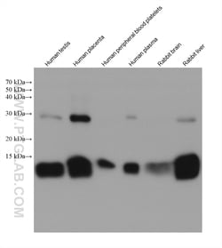 HBB Mouse Monoclonal Antibody, Proteintech Unconjugated; 150 &mu;L:Antibodies,