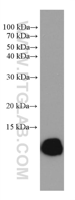 HBZ Mouse Monoclonal Antibody, Proteintech Unconjugated; 150 &mu;L:Antibodies,