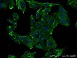 HDDC2 Mouse Monoclonal Antibody, Proteintech:Antibodies:Primary Antibodies