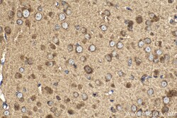 HDDC2 Mouse Monoclonal Antibody, Proteintech:Antibodies:Primary Antibodies