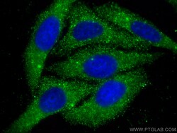 HGS Mouse Monoclonal Antibody, Proteintech Unconjugated; 150 &mu;L:Antibodies,