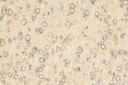 HGS Mouse Monoclonal Antibody, Proteintech Unconjugated; 150 &mu;L:Antibodies,
