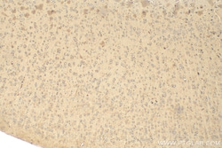 HGS Mouse Monoclonal Antibody, Proteintech Unconjugated; 150 &mu;L:Antibodies,