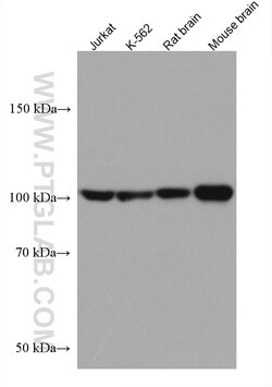 HGS Mouse Monoclonal Antibody, Proteintech Unconjugated; 150 &mu;L:Antibodies,
