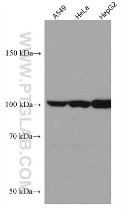 HGS Mouse Monoclonal Antibody, Proteintech Unconjugated; 150 &mu;L:Antibodies,