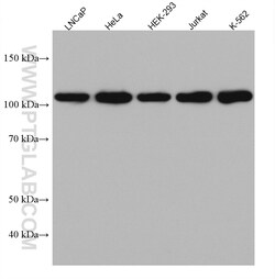 HGS Mouse Monoclonal Antibody, Proteintech Unconjugated; 150 &mu;L:Antibodies,
