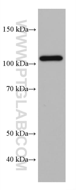 HGS Mouse Monoclonal Antibody, Proteintech Unconjugated; 150 &mu;L:Antibodies,
