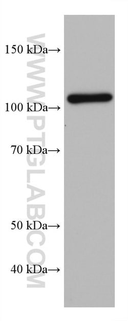 HGS Mouse Monoclonal Antibody, Proteintech Unconjugated; 150 &mu;L:Antibodies,