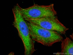 HIBCH Mouse Monoclonal Antibody, Proteintech:Antibodies:Primary Antibodies