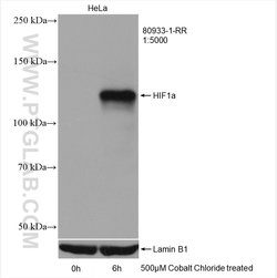 HIF1a Rabbit anti-Human, Clone: 2K1, Proteintech:Antibodies:Primary Antibodies