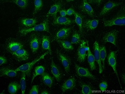 HIP14; ZDHHC17 Rabbit Polyclonal Antibody, Proteintech Unconjugated; 150