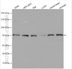 HIP14; ZDHHC17 Rabbit Polyclonal Antibody, Proteintech Unconjugated; 150