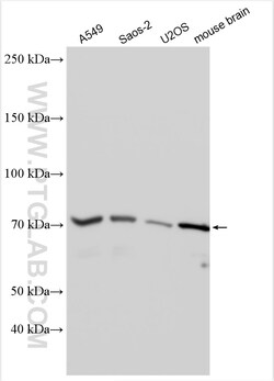 HIP14; ZDHHC17 Rabbit Polyclonal Antibody, Proteintech Unconjugated; 150