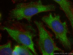 HIP1R Mouse Monoclonal Antibody, Proteintech Unconjugated; 150 &mu;L:Antibodies,