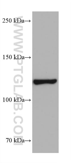 HIP1R Mouse Monoclonal Antibody, Proteintech Unconjugated; 150 &mu;L:Antibodies,