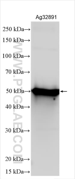 HIV-1-P24 Rabbit Polyclonal Antibody, Proteintech Unconjugated; 150 &mu;L:Antikörper