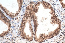 HMGA1 Rabbit Polyclonal Antibody, Proteintech 150 &mu;L | Buy Online | Proteintech | Fisher Scientific