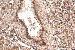 HMGA1 Rabbit Polyclonal Antibody, Proteintech 150 &mu;L | Buy Online | Proteintech | Fisher Scientific