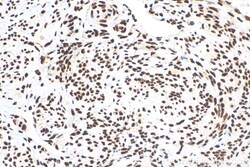 HNRNPD Mouse Monoclonal Antibody, Proteintech Unconjugated; 20 &mu;L:Antibodies,