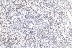 HNRNPD Mouse Monoclonal Antibody, Proteintech Unconjugated; 20 &mu;L:Antibodies,