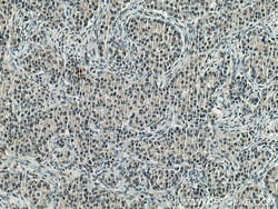 HNRNPK Mouse Monoclonal Antibody, Proteintech Unconjugated; 150 &mu;L:Antibodies,
