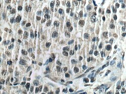 HNRNPK Mouse Monoclonal Antibody, Proteintech Unconjugated; 150 &mu;L:Antibodies,