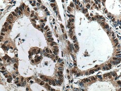 HNRNPK Mouse Monoclonal Antibody, Proteintech Unconjugated; 150 &mu;L:Antibodies,