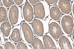 HSD3B2 Rabbit Polyclonal Antibody, Proteintech:Antibodies:Primary Antibodies