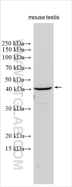 HSD3B2 Rabbit Polyclonal Antibody, Proteintech:Antibodies:Primary Antibodies