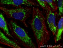 HSDL2 Mouse Monoclonal Antibody, Proteintech:Antibodies:Primary Antibodies