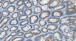 HSP70 Rabbit Recombinant Antibody, Proteintech:Antibodies:Primary Antibodies