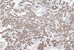 HSP70 Rabbit Recombinant Antibody, Proteintech:Antibodies:Primary Antibodies