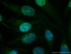 HSPB3 Mouse Monoclonal Antibody, Proteintech:Antibodies:Primary Antibodies