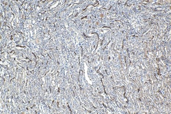 HSPB3 Mouse Monoclonal Antibody, Proteintech:Antibodies:Primary Antibodies