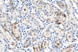 HSPB3 Mouse Monoclonal Antibody, Proteintech:Antibodies:Primary Antibodies