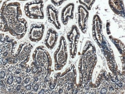 5HT2A Receptor Rabbit Polyclonal Antibody, Proteintech:Anticorps:Anticorps