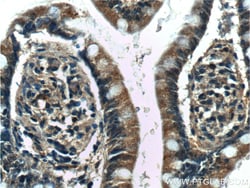5HT2A Receptor Rabbit Polyclonal Antibody, Proteintech:Anticorps:Anticorps