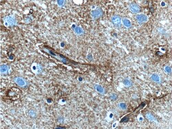 5HT2A Receptor Rabbit Polyclonal Antibody, Proteintech:Anticorps:Anticorps