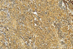 HTRA1 Rabbit Polyclonal Antibody, Proteintech Unconjugated; 20 &mu;L:Antibodies,