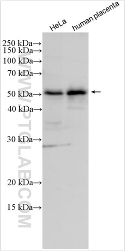 HTRA1 Rabbit Polyclonal Antibody, Proteintech Unconjugated; 20 &mu;L:Antibodies,