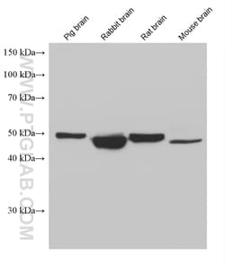 HTRA1 Mouse Monoclonal Antibody, Proteintech:Antibodies:Primary Antibodies