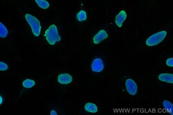 Histone H2B Mouse Monoclonal Antibody, Proteintech:Antibodies:Primary Antibodies