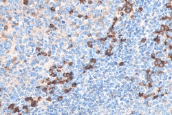 Biotin-conjugated Human IgG Rabbit Polyclonal Antibody, Proteintech Biotin;