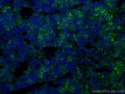 CoraLite Plus 488-conjugated ICAM4 Mouse Monoclonal Antibody, Proteintech