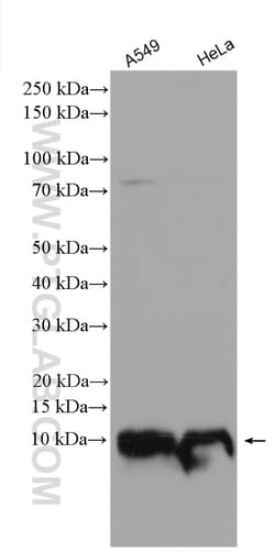 IER3IP1 Rabbit Polyclonal Antibody, Proteintech Unconjugated; 20 &mu;L:Antibodies,