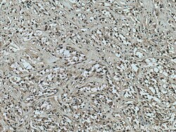 IFI16 Rabbit Polyclonal Antibody, Proteintech Unconjugated; 20 &mu;L:Antibodies,