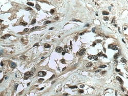 IFI16 Rabbit Polyclonal Antibody, Proteintech Unconjugated; 20 &mu;L:Antibodies,