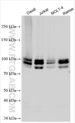 IFI16 Rabbit Polyclonal Antibody, Proteintech Unconjugated; 20 &mu;L:Antibodies,