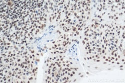 IFI16 Mouse Monoclonal Antibody, Proteintech Unconjugated; 20 &mu;L:Antibodies,